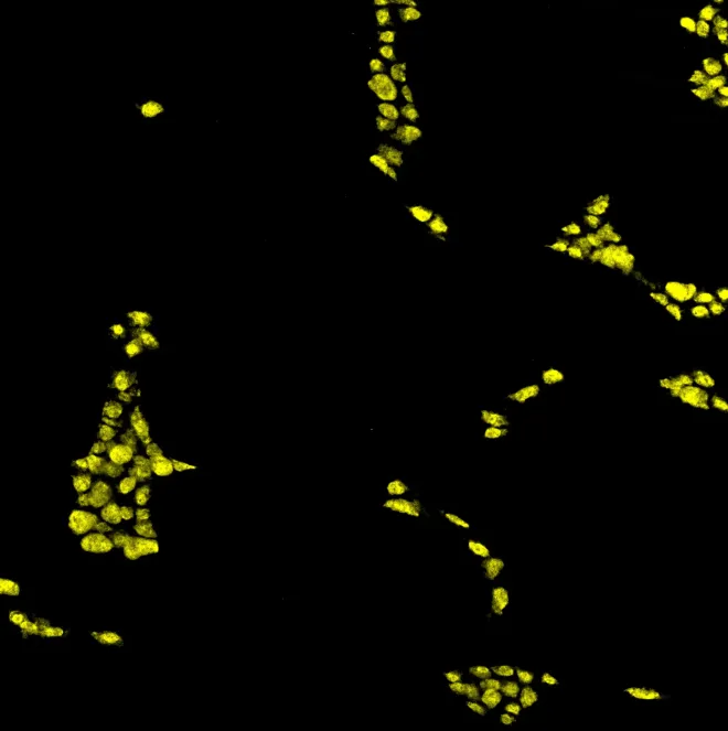 Neuron